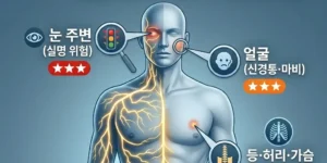 대상포진 위치별 증상 총정리, 눈·얼굴에 생기면 즉시 응급실로!